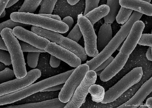 Electron microscopy image showing rod-shaped E. coli bacteria cells clustered together against a dark background.
