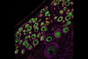 Fluorescent microscopy image showing green and purple-stained egg cells arranged in ovarian tissue against a dark background.