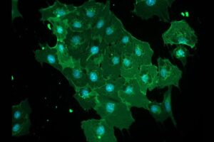Fluorescent microscopy image showing green-glowing cells with bright nuclei against a dark background, illustrating viral