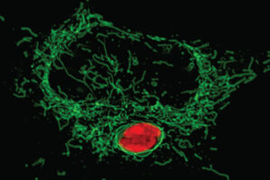 Microscopic image of a cell with green filaments surrounding a red central nucleus against a black background