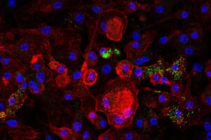 Fluorescent microscopy image showing cells with red cytoplasm, blue nuclei, and green protein markers
