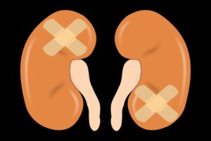 Illustration of two kidneys, each with a crossed bandage, representing kidney injury or disease.