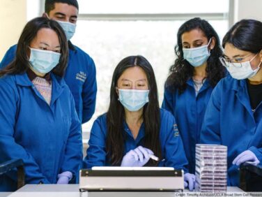 UCLA research: A lesser-known SARS-CoV-2 protein may offer clues to long COVID symptoms